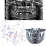 diagnostic